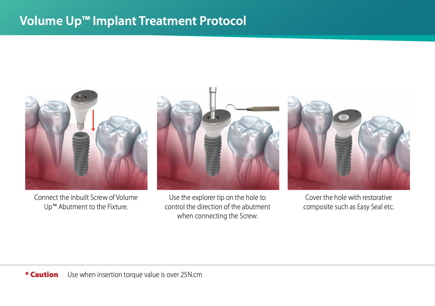 Cowellmedi Volume up™ Healing Abutment