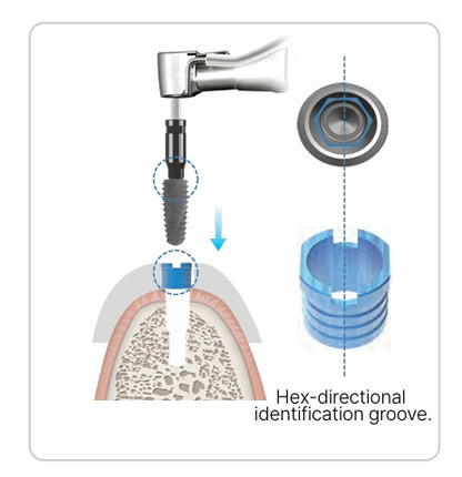 Cowellmedi Lodestar Guided Surgery Sleeves (Pack of 5)
